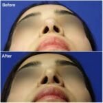 A Comprehensive Guide to Ultrasonic Treatments in Dubai with Dr. Shahram