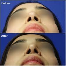 A Comprehensive Guide to Ultrasonic Treatments in Dubai with Dr. Shahram