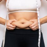 Liposuction surgery