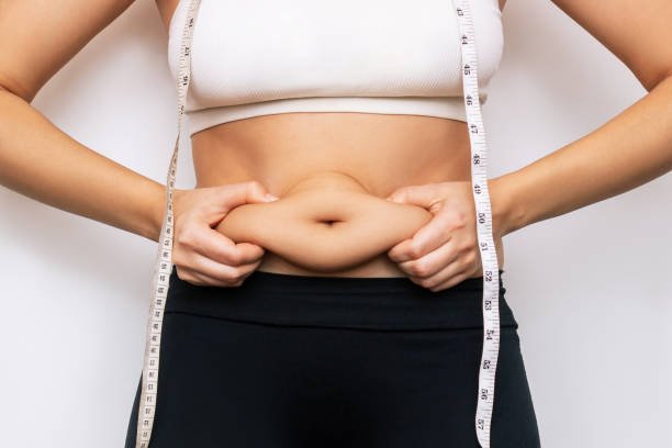 Liposuction surgery